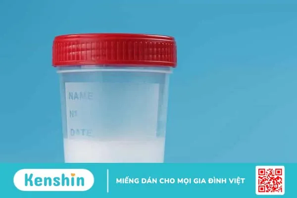 Hỏi Đáp Bác sĩ: Lâu ngày không quan hệ tinh trùng như thế nào?