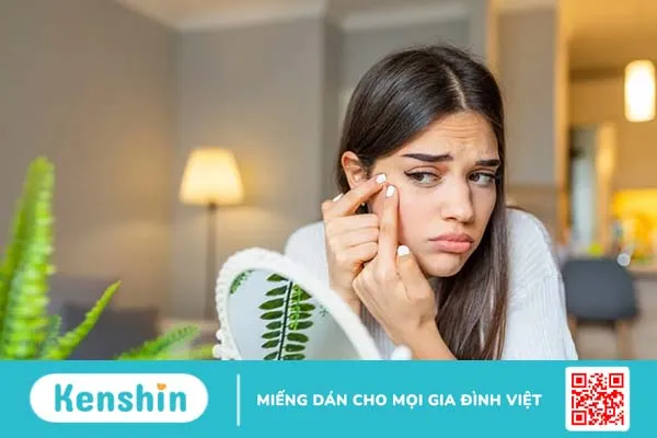 Hỏi đáp Bác sĩ: Nặn mụn xong bị sưng đỏ nên làm gì?