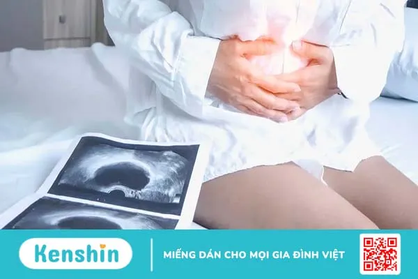 Hỏi đáp Bác sĩ: Nang đơn thùy buồng trứng phải có nguy hiểm không?