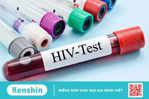 Hỏi đáp Bác sĩ: Nhiễm HIV bao lâu thì phát bệnh?