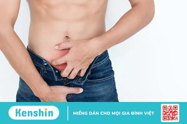 Hỏi đáp Bác sĩ: Nổi mụn ở bộ phận sinh dục nam, lúc ngứa lúc không ngứa có sao không?