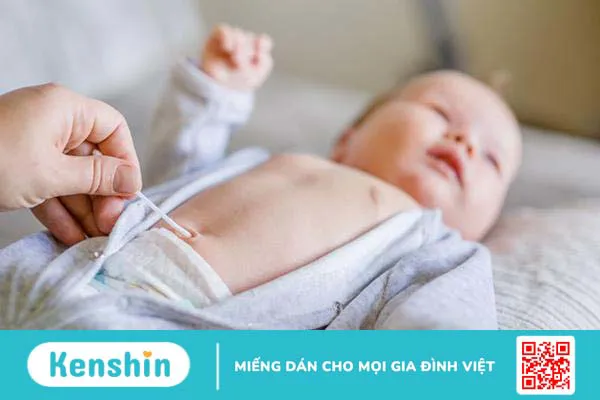 Hỏi đáp Bác sĩ: Rốn trẻ sơ sinh bị nhiễm trùng phải làm sao?