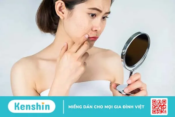 Hỏi đáp Bác sĩ: Thâm mụn bao lâu thì hết?