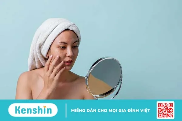 Hỏi đáp bác sĩ: Uống thuốc tránh thai bị nám da phải làm sao?