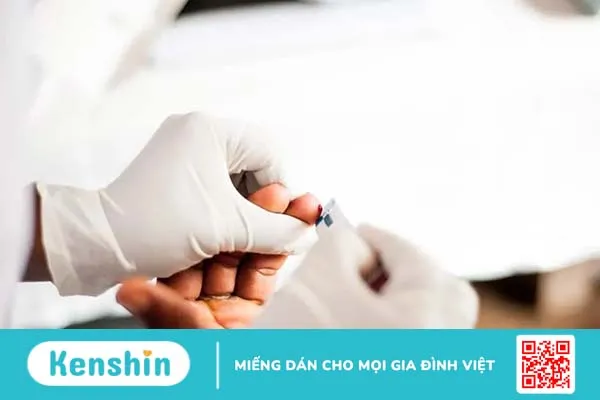 Hỏi đáp Bác sĩ: Xét nghiệm HIV sau 3 tháng có chính xác không?