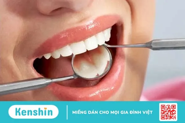 [Hỏi đáp cùng nha sĩ] 8 câu hỏi phổ biến nhất về răng miệng