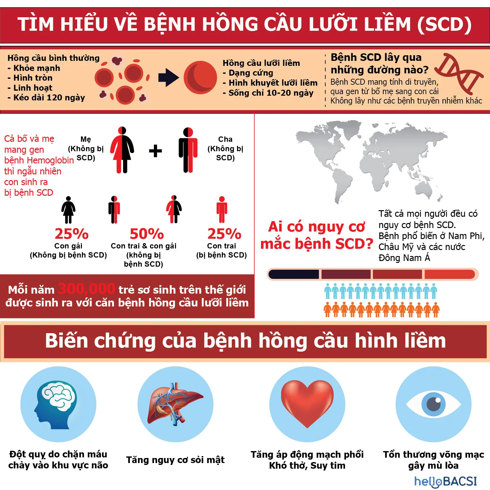 Hồng cầu lưỡi liềm