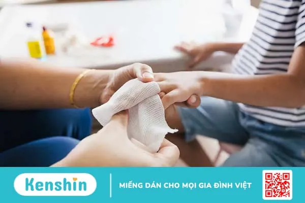 Hướng dẫn 3 cách cầm máu nhanh khi bị đứt tay chảy máu nhiều