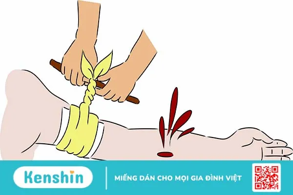 Hướng dẫn 3 cách cầm máu nhanh khi bị đứt tay chảy máu nhiều