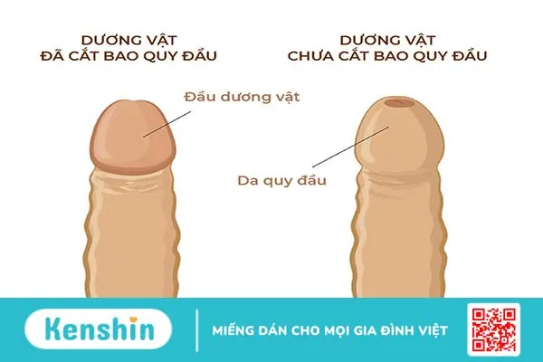 Hướng dẫn cách chăm sóc và điều trị sẹo sau khi cắt bao quy đầu