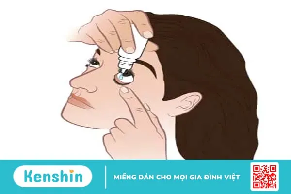 Hướng dẫn cách sử dụng thuốc nhỏ mắt đúng cách