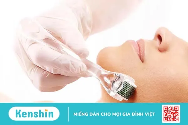 Hướng dẫn chăm sóc da sau lăn kim PRP đúng cách