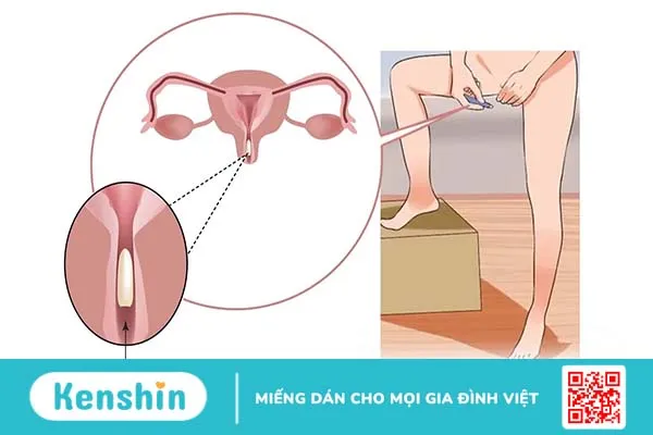 Hướng dẫn chi tiết cách sử dụng viên đặt phụ khoa