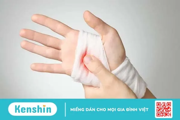 Hướng dẫn sơ cứu khi chảy máu để ngăn ngừa nhiễm trùng