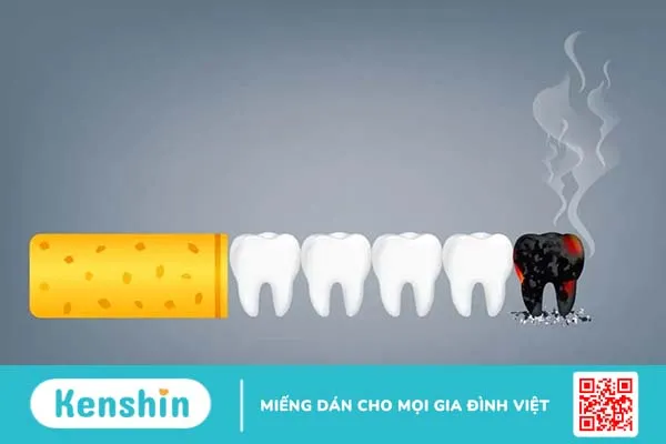 Hút thuốc lá có hại cho răng miệng ra sao? Cách bỏ thuốc lá hiệu quả