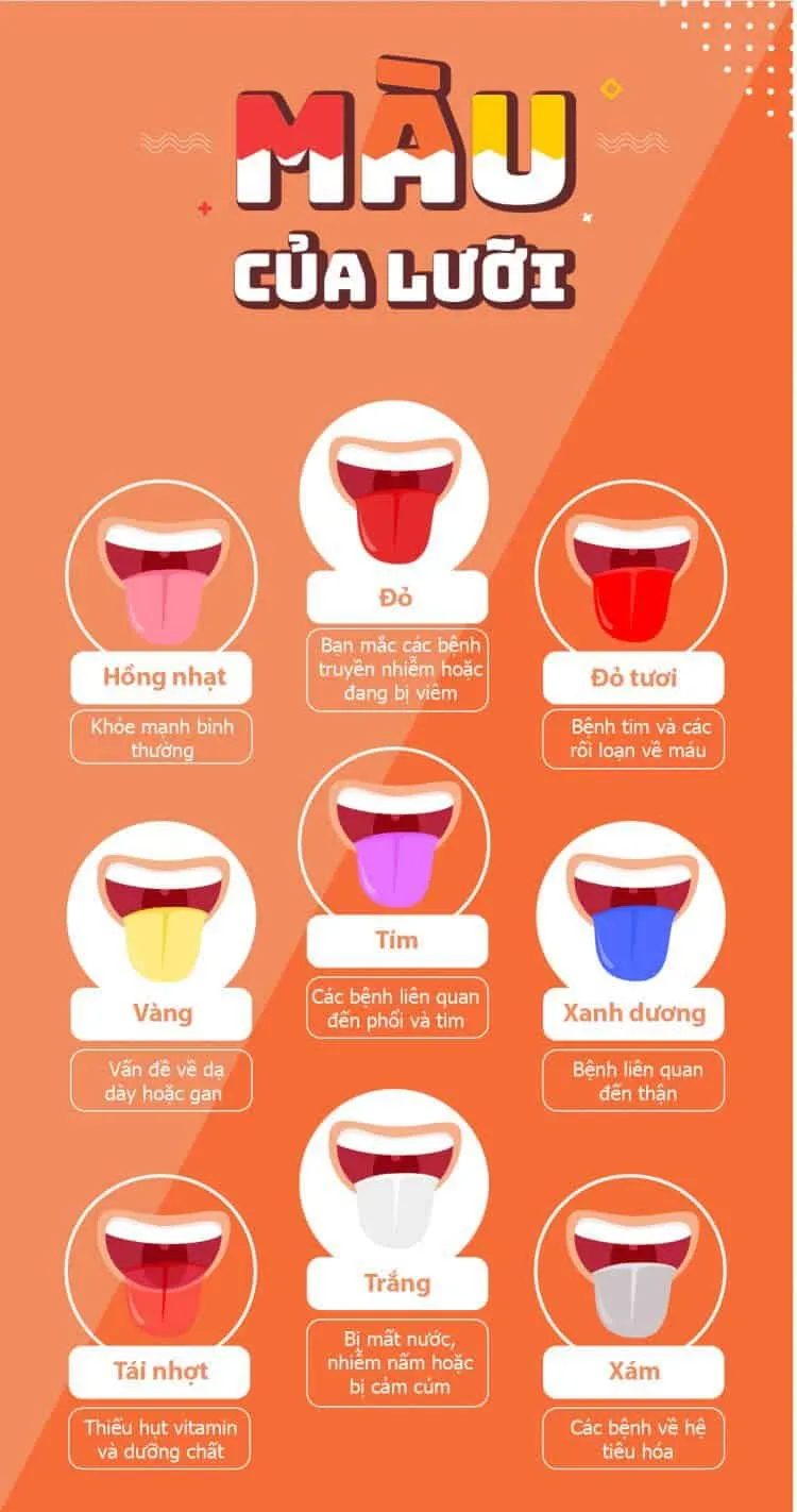 [Infographic] Màu lưỡi tiết lộ nhiều điều về sức khỏe của bạn