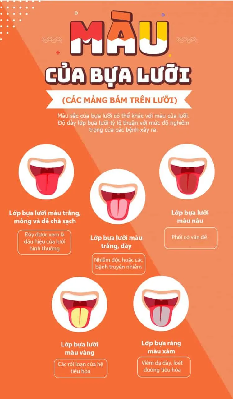 [Infographic] Màu lưỡi tiết lộ nhiều điều về sức khỏe của bạn