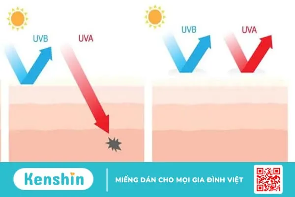 Kem chống nắng cho da nhạy cảm: Lựa chọn sao cho đúng?