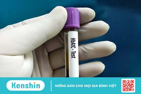 Kết quả định lượng chỉ số HbA1c bao nhiêu là bị tiểu đường?