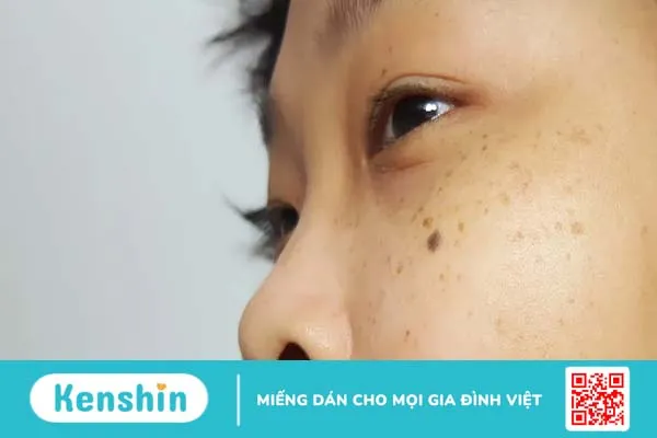 Khám phá 7 cách skincare cho da không đều màu