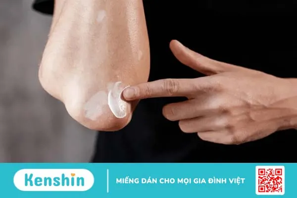 Khám phá những cách chữa bệnh bạch biến hiệu quả