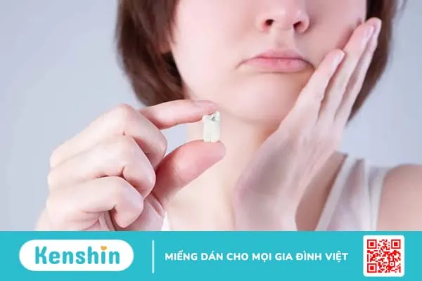 Khi nào nên nhổ răng sâu? Những lưu ý sau khi nhổ răng