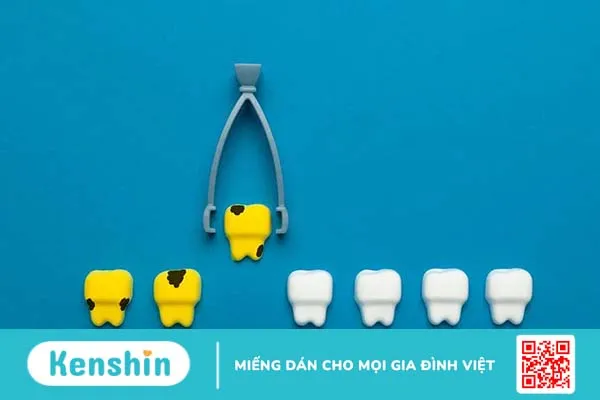 Khi nào nên nhổ răng sữa cho bé? Nhổ răng sữa tại nhà cần lưu ý điều gì?