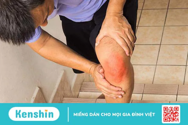 Khô khớp gối: Nguyên nhân và biện pháp khắc phục