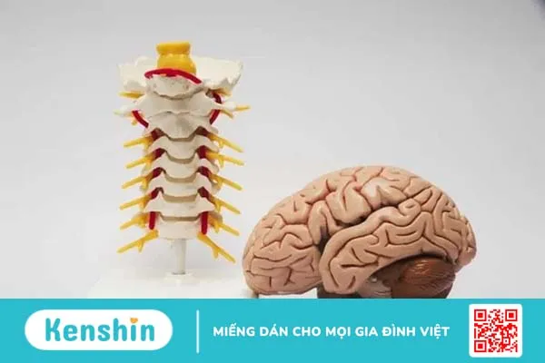 Kích thích thần kinh phế vị: Thêm hy vọng cho bệnh nhân động kinh