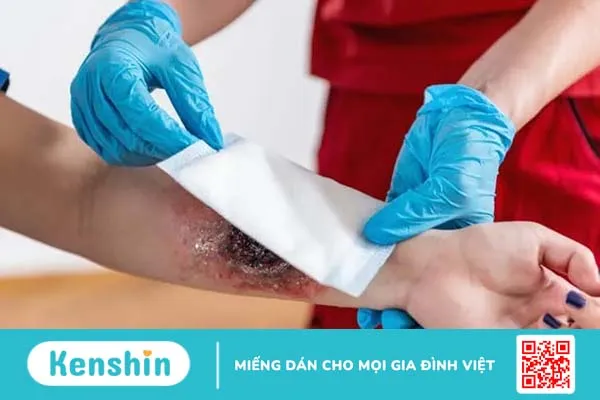 Kỹ năng sơ cấp cứu cho các tai nạn thường gặp