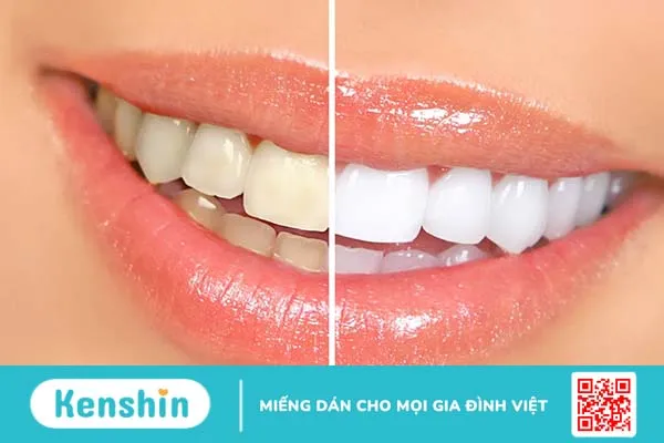 LÀM ĐẸP BẰNG GIẤM TÁO: 10 lợi ích tuyệt vời bạn không thể bỏ qua