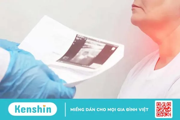 Làm sao để chữa khỏi ung thư tuyến giáp giai đoạn 2?