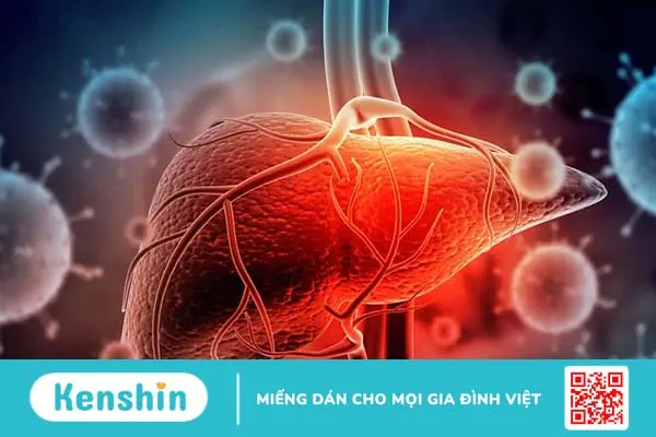 Làm sao nhận biết các triệu chứng suy gan? Những dấu hiệu không nên bỏ qua