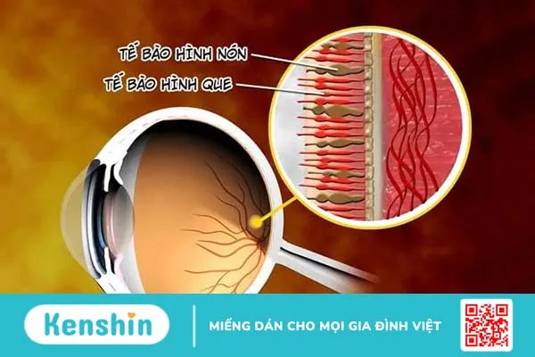 Làm thế nào để kiểm tra mù màu? Nguyên nhân và cách nhận biết bệnh