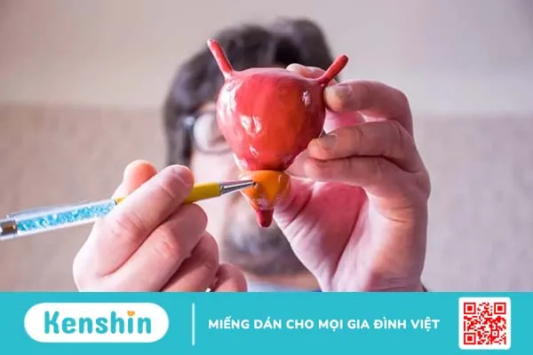 Làm thế nào điều trị phì đại tuyến tiền liệt hiệu quả?