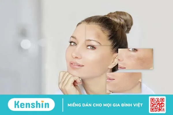 Làn da thay đổi khi mang thai: Bật mí mẹo chăm sóc da bà bầu hiệu quả