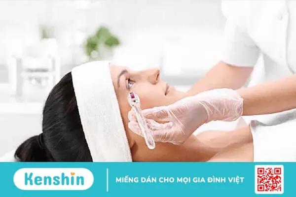 Lăn kim siêu vi điểm: Giải pháp trị sẹo và làm đẹp da