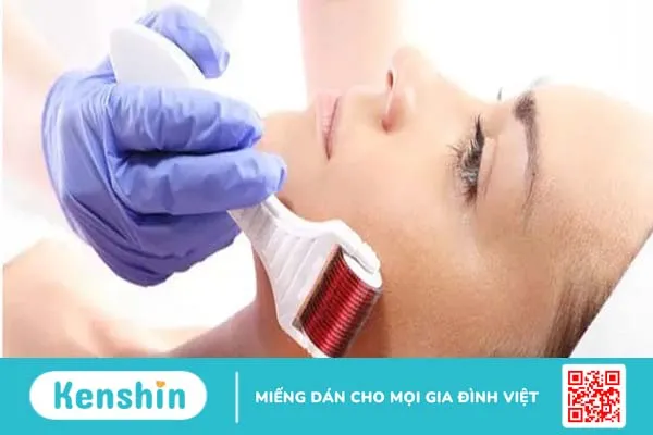 Lăn kim siêu vi điểm: Giải pháp trị sẹo và làm đẹp da