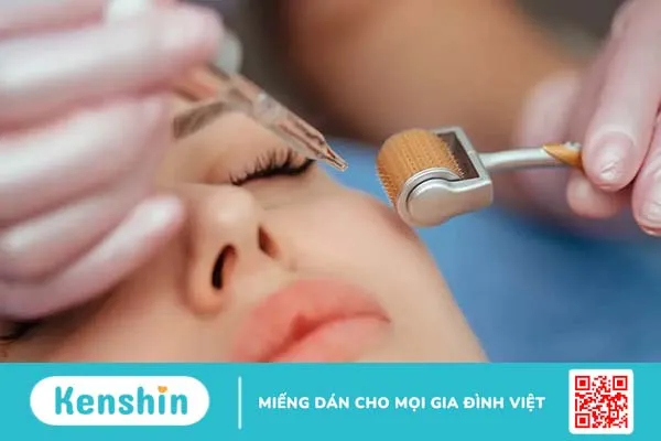 Lăn kim trị nám có tốt không? Những điều cần biết về lăn kim