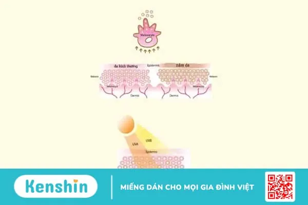 Lật tẩy 8 thủ phạm gây nám da