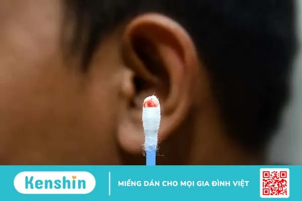 Lấy ráy tai bị chảy máu có sao không? Cách xử lý khi ngoáy tai chảy máu