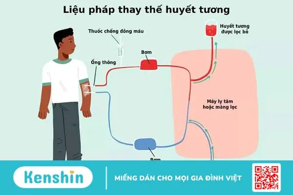 Liệu pháp thay thế huyết tương