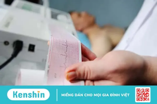 Loạn nhịp xoang: Rối loạn nhịp tim lành tính