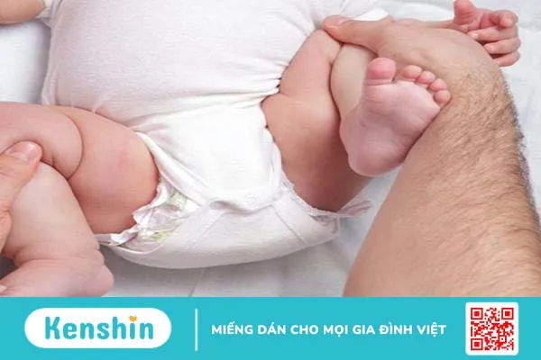 Loạn sản khớp háng:Những điều bạn cần nên biết!