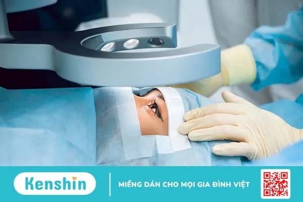 Loạn thị có mổ được không và các phương pháp mổ phổ biến?