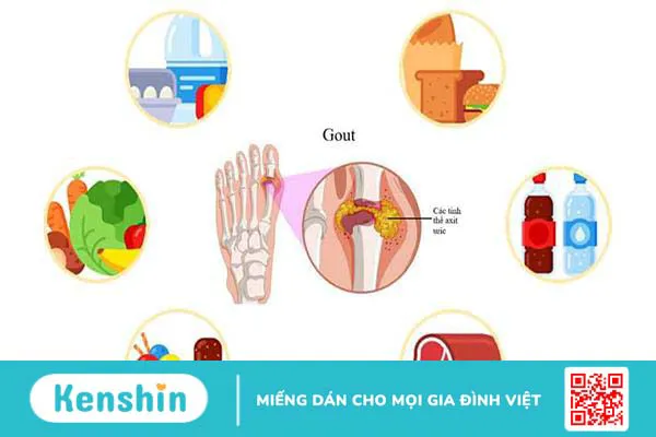 Lưu ý chế độ ăn kiêng cho người bị gout