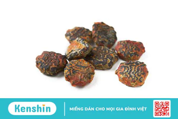 Mách bạn 6 mẹo dân gian chữa đau vai gáy cực hiệu quả