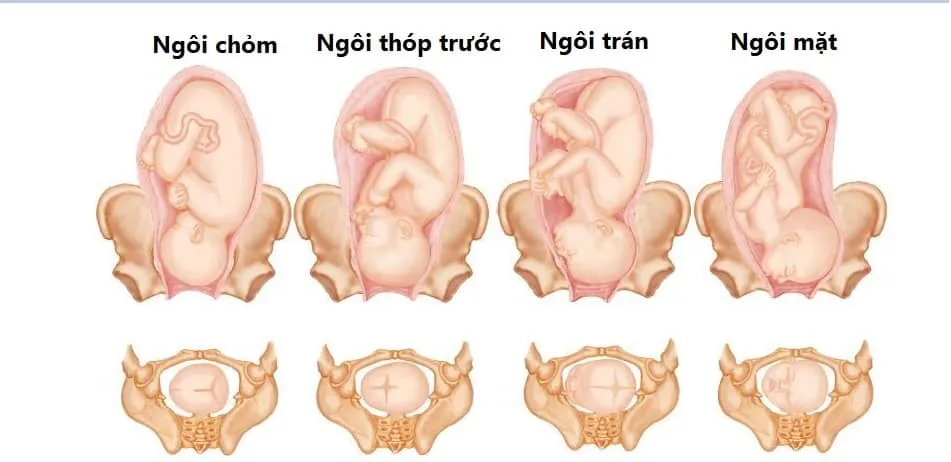 Mách mẹ dấu hiệu nhận biết ngôi thai thuận “chuẩn” như chuyên gia