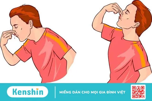 Mách nhỏ 4 mẹo vặt chữa chảy máu cam ai cũng nên biết