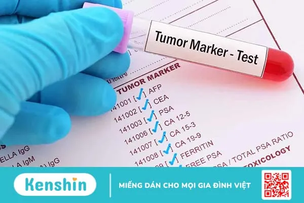 Marker ung thư là gì? Marker của các bệnh ung thư thường gặp